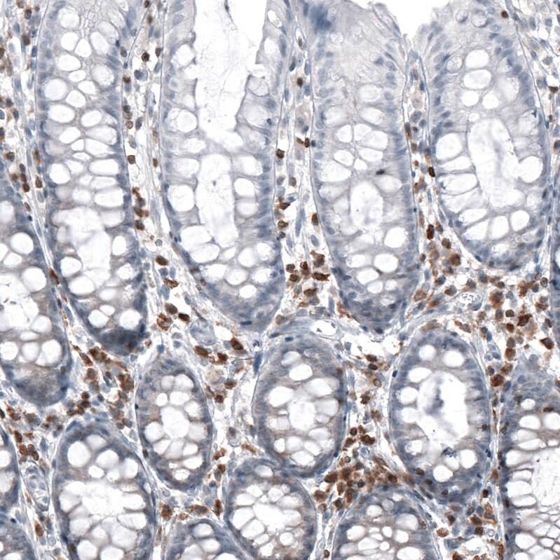 Bcl-2 Antibody (CL7935) - Azide and BSA Free Immunohistochemistry-Paraffin: Bcl-2 Antibody [NBP3-44218]