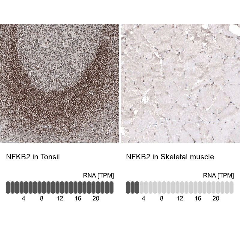 NFkB2/NFkB p100 Antibody (CL8266) - Azide and BSA Free Immunohistochemistry-Paraffin: NFkB2/NFkB p100 Antibody [NBP3-44219]