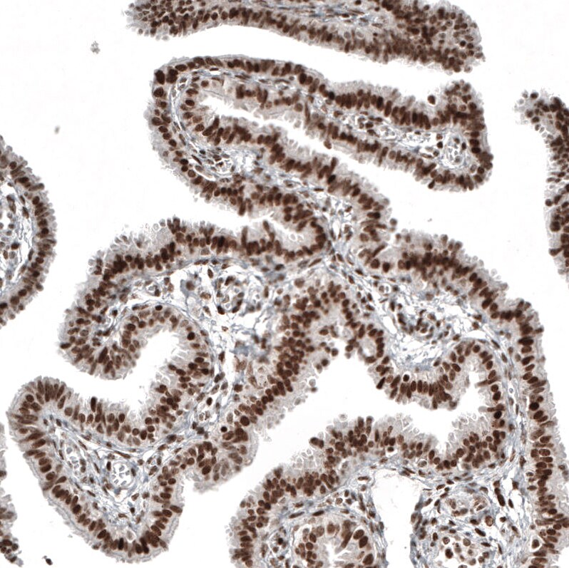 NFkB2/NFkB p100 Antibody (CL8266) - Azide and BSA Free Immunohistochemistry-Paraffin: NFkB2/NFkB p100 Antibody [NBP3-44219]