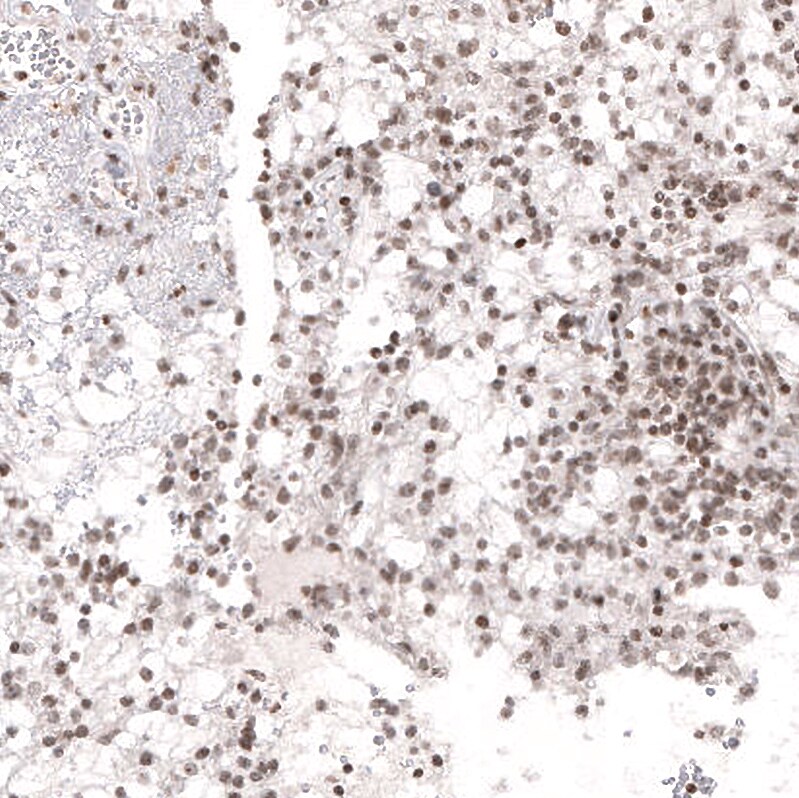 NFkB2/NFkB p100 Antibody (CL8266) - Azide and BSA Free Immunohistochemistry-Paraffin: NFkB2/NFkB p100 Antibody [NBP3-44219]