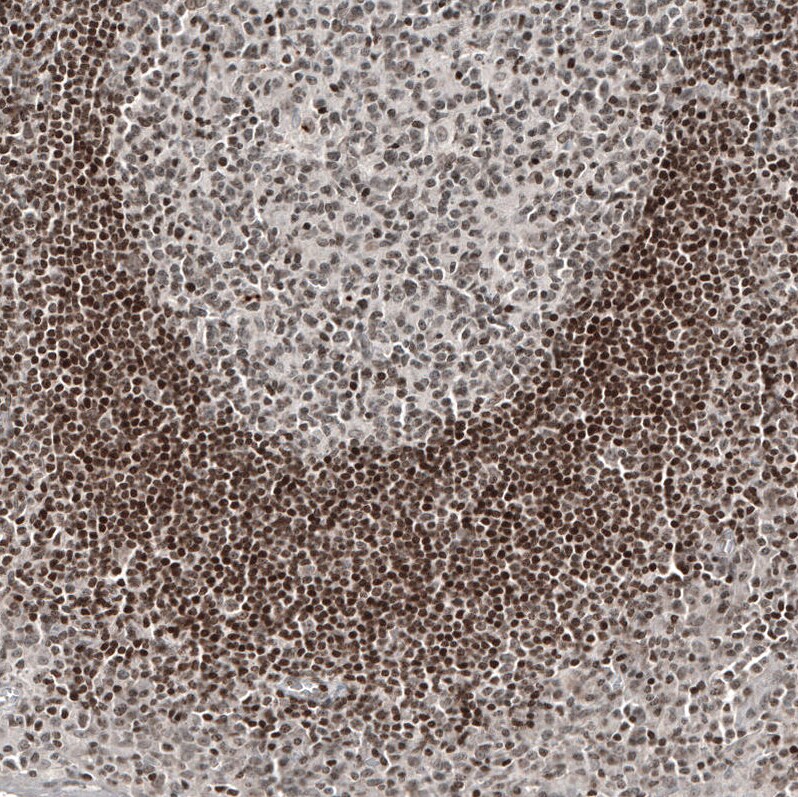 NFkB2/NFkB p100 Antibody (CL8266) - Azide and BSA Free Immunohistochemistry-Paraffin: NFkB2/NFkB p100 Antibody [NBP3-44219]