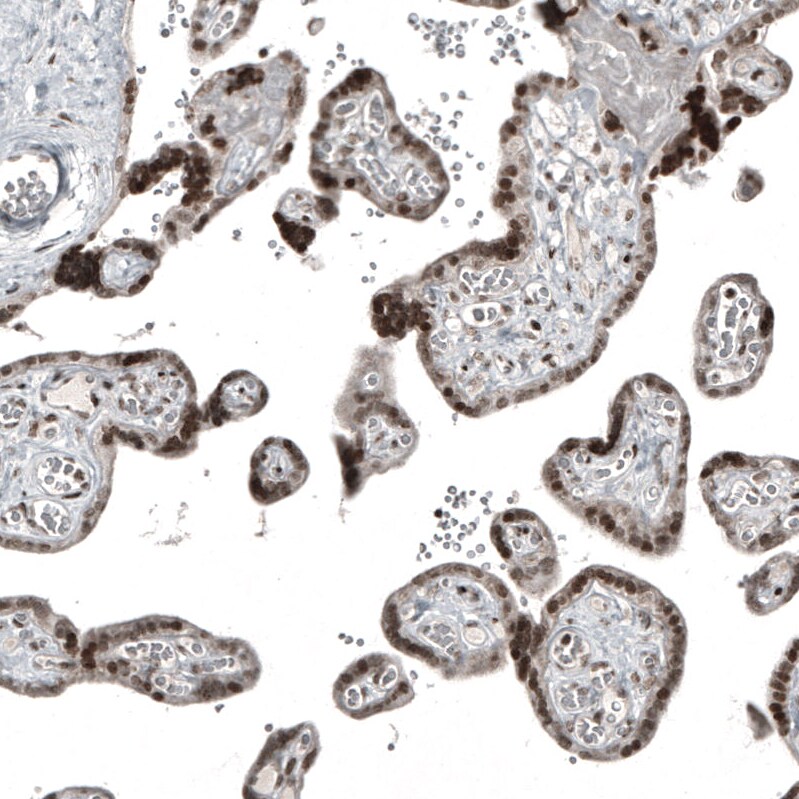NFkB2/NFkB p100 Antibody (CL8266) - Azide and BSA Free Immunohistochemistry-Paraffin: NFkB2/NFkB p100 Antibody [NBP3-44219]