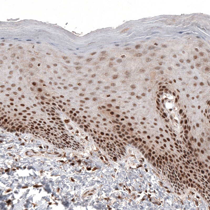 CDK4 Antibody (CL8102) - Azide and BSA Free Immunohistochemistry-Paraffin: CDK4 Antibody [NBP3-44220]
