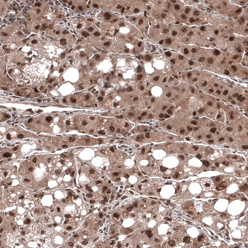 CDK4 Antibody (CL8102) - Azide and BSA Free Immunohistochemistry-Paraffin: CDK4 Antibody [NBP3-44220]