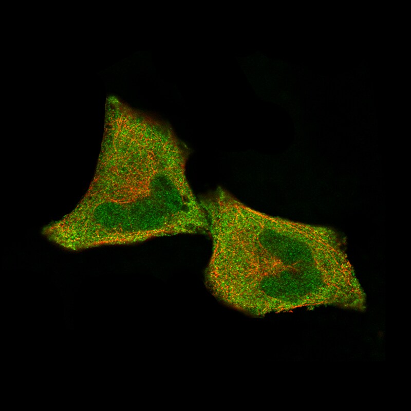 CDK4 Antibody (CL8102) - Azide and BSA Free Immunocytochemistry/ Immunofluorescence: CDK4 Antibody [NBP3-44220]