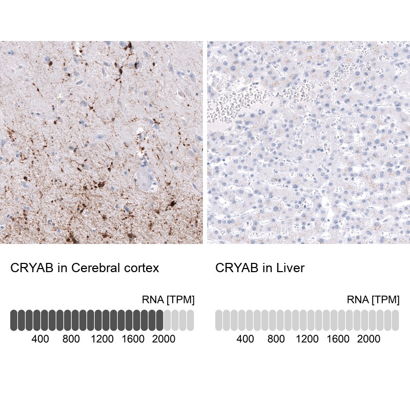 AlphaB Crystallin/CRYAB Antibody (CL10765) - Azide and BSA Free Immunohistochemistry-Paraffin: AlphaB Crystallin/CRYAB Antibody [NBP3-44221]