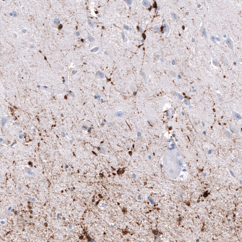 AlphaB Crystallin/CRYAB Antibody (CL10765) - Azide and BSA Free Immunohistochemistry-Paraffin: AlphaB Crystallin/CRYAB Antibody [NBP3-44221]