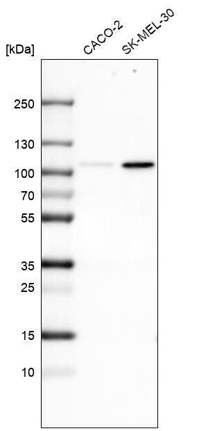 SOX6 Antibody (CL5685) - Azide and BSA Free Western Blot: SOX6 Antibody [NBP3-44222]