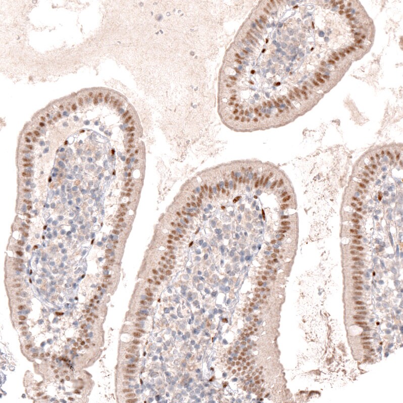SOX6 Antibody (CL5690) - Azide and BSA Free Immunohistochemistry-Paraffin: SOX6 Antibody [NBP3-44223]