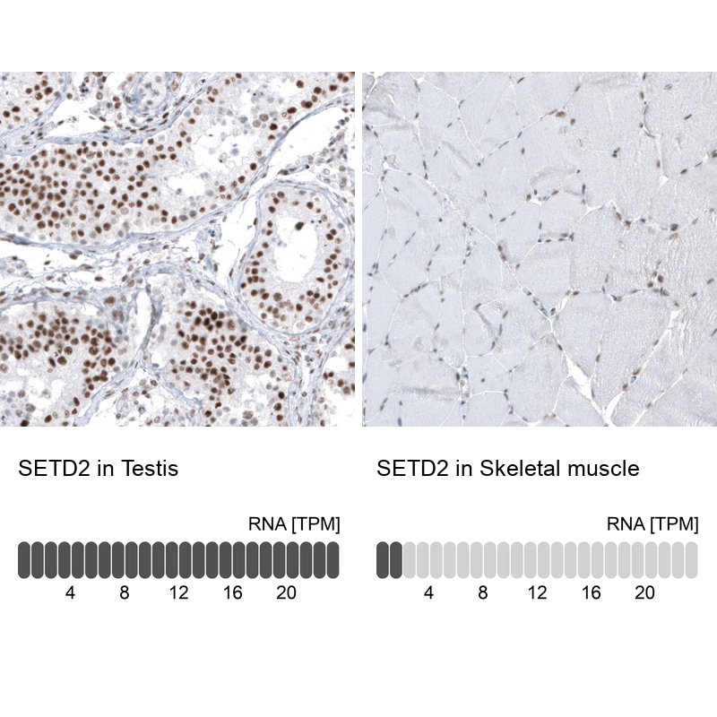 HYPB Antibody (CL9956) - Azide and BSA Free Immunohistochemistry-Paraffin: HYPB Antibody [NBP3-44227]