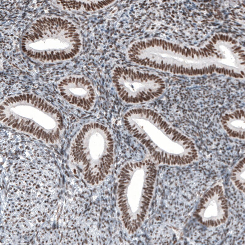 HYPB Antibody (CL9956) - Azide and BSA Free Immunohistochemistry-Paraffin: HYPB Antibody [NBP3-44227]