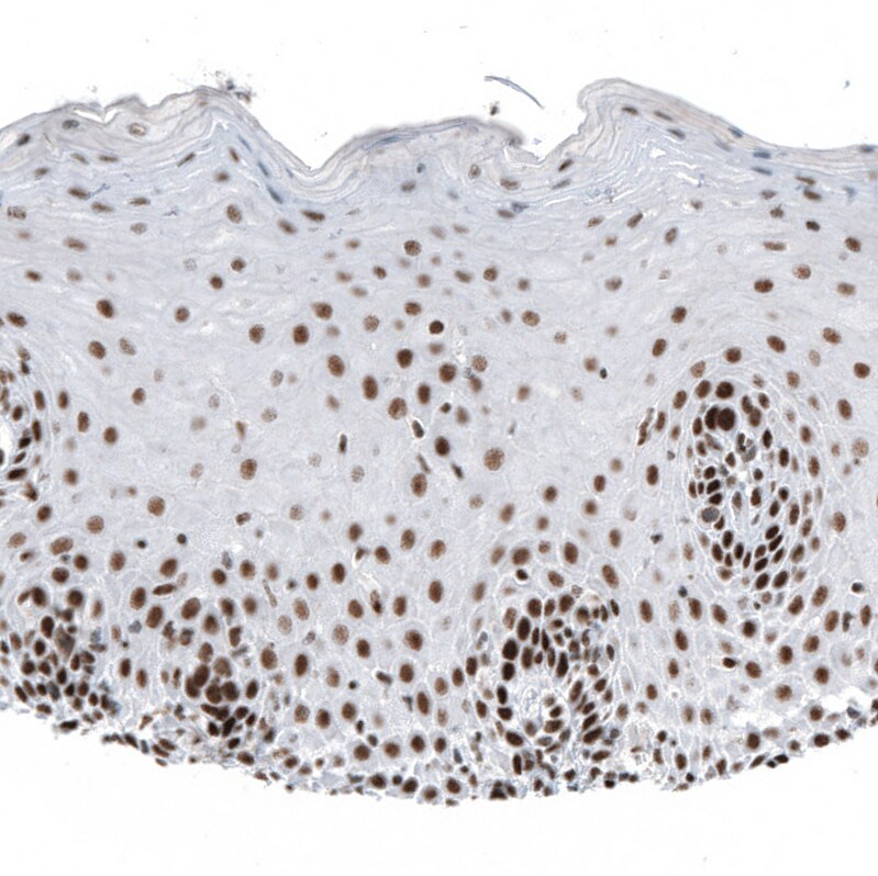 HYPB Antibody (CL9956) - Azide and BSA Free Immunohistochemistry-Paraffin: HYPB Antibody [NBP3-44227]