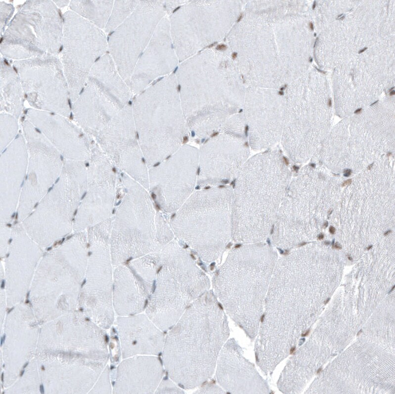 HYPB Antibody (CL9956) - Azide and BSA Free Immunohistochemistry-Paraffin: HYPB Antibody [NBP3-44227]