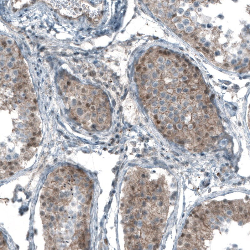 Smad2 Antibody (CL8472) - Azide and BSA Free Immunohistochemistry-Paraffin: Smad2 Antibody [NBP3-44228]