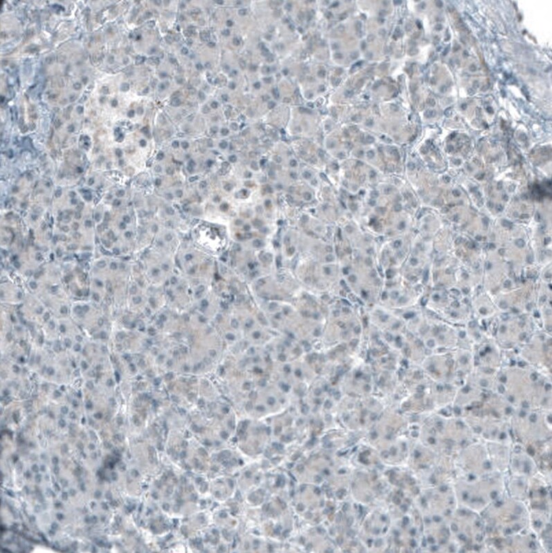 Smad2 Antibody (CL8472) - Azide and BSA Free Immunohistochemistry-Paraffin: Smad2 Antibody [NBP3-44228]