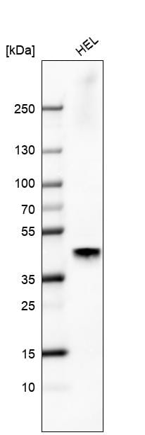 SF-1/NR5A1/Steroidogenic Factor 1 Antibody (CL9101) - Azide and BSA Free Western Blot: SF-1/NR5A1/Steroidogenic Factor 1 Antibody [NBP3-44229]