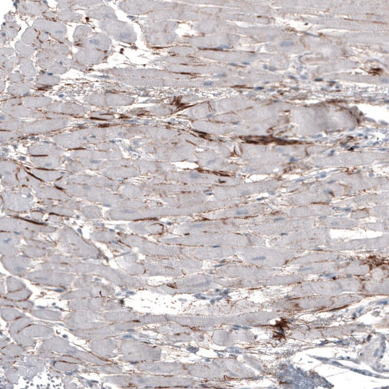FGF18 Antibody (CL7628) - Azide and BSA Free Immunohistochemistry-Paraffin: FGF18 Antibody [NBP3-44231]
