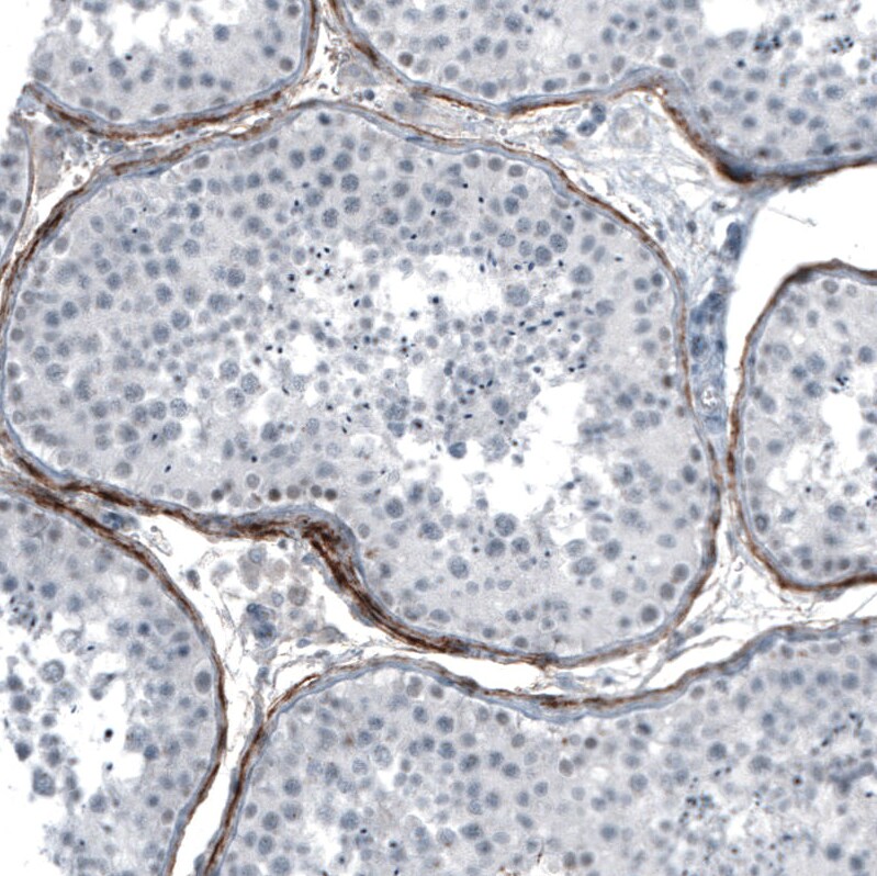 FGF18 Antibody (CL7628) - Azide and BSA Free Immunohistochemistry-Paraffin: FGF18 Antibody [NBP3-44231]