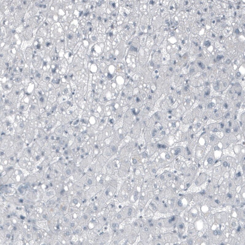 FGF18 Antibody (CL7628) - Azide and BSA Free Immunohistochemistry-Paraffin: FGF18 Antibody [NBP3-44231]
