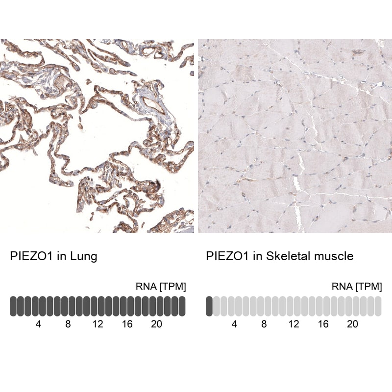 PIEZO1 Antibody (CL9714) - Azide and BSA Free Immunohistochemistry-Paraffin: PIEZO1 Antibody [NBP3-44234]