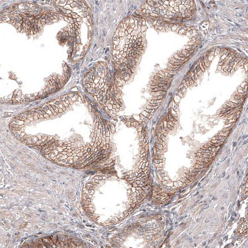 PIEZO1 Antibody (CL9714) - Azide and BSA Free Immunohistochemistry-Paraffin: PIEZO1 Antibody [NBP3-44234]