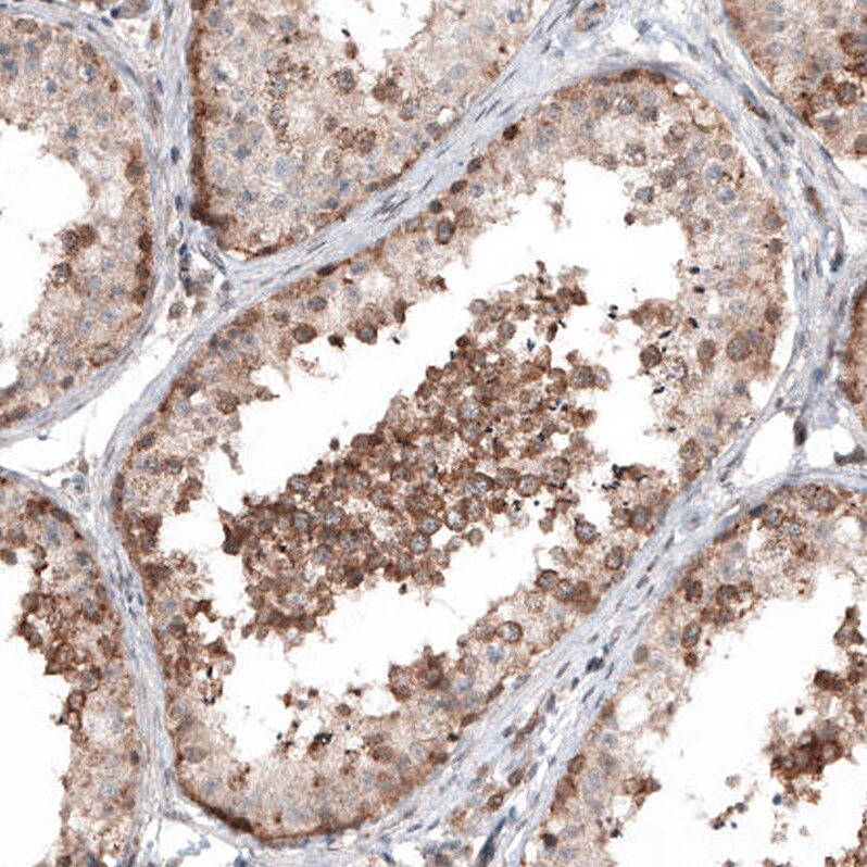 IL-4I1 Antibody (CL9071) - Azide and BSA Free Immunohistochemistry-Paraffin: IL-4I1 Antibody [NBP3-44235]