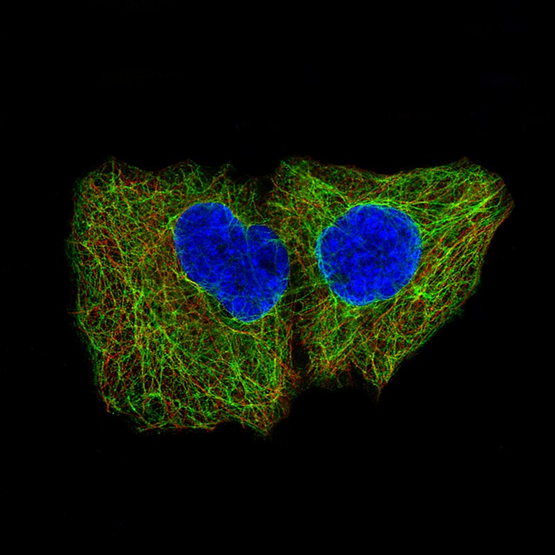 Cytokeratin 5 Antibody (CL9297) - Azide and BSA Free Immunocytochemistry/ Immunofluorescence: Cytokeratin 5 Antibody [NBP3-44236]