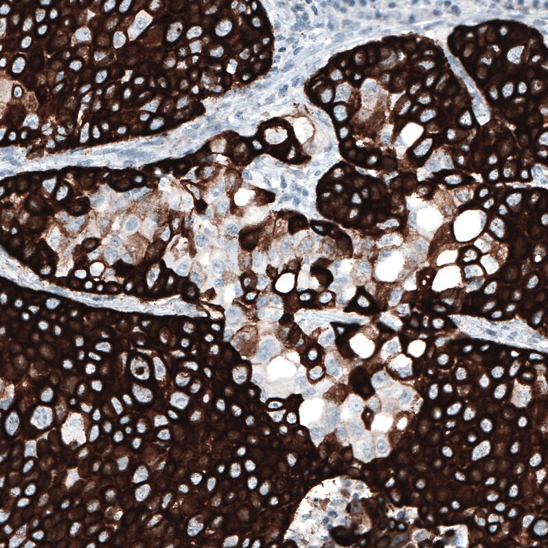 Cytokeratin 5 Antibody (CL9297) - Azide and BSA Free Immunohistochemistry-Paraffin: Cytokeratin 5 Antibody [NBP3-44236]