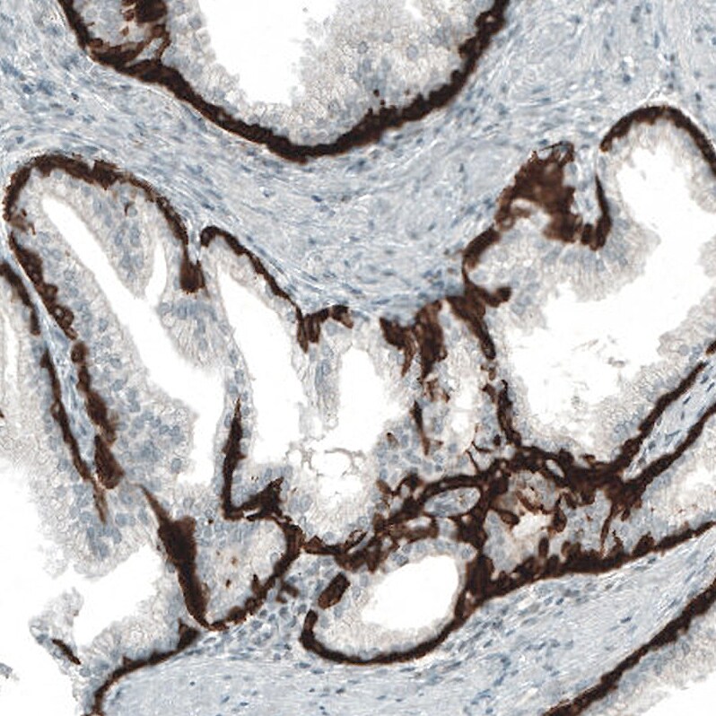 Cytokeratin 5 Antibody (CL9297) - Azide and BSA Free Immunohistochemistry-Paraffin: Cytokeratin 5 Antibody [NBP3-44236]