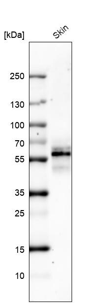Cytokeratin 5 Antibody (CL9297) - Azide and BSA Free Western Blot: Cytokeratin 5 Antibody [NBP3-44236]