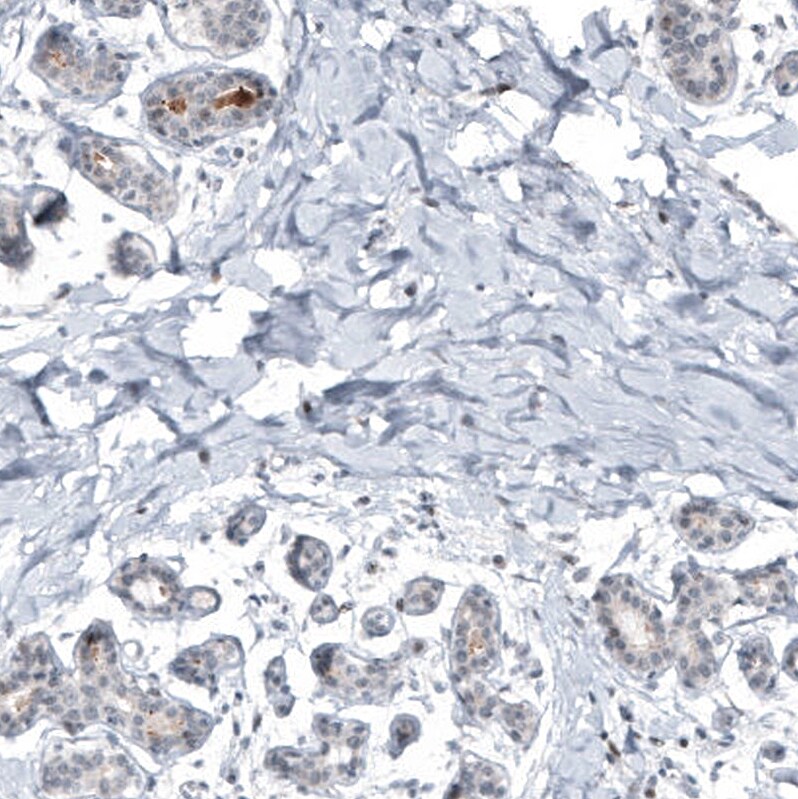 Mammaglobin A Antibody (CL8892) - Azide and BSA Free Immunohistochemistry-Paraffin: Mammaglobin A Antibody [NBP3-44237]