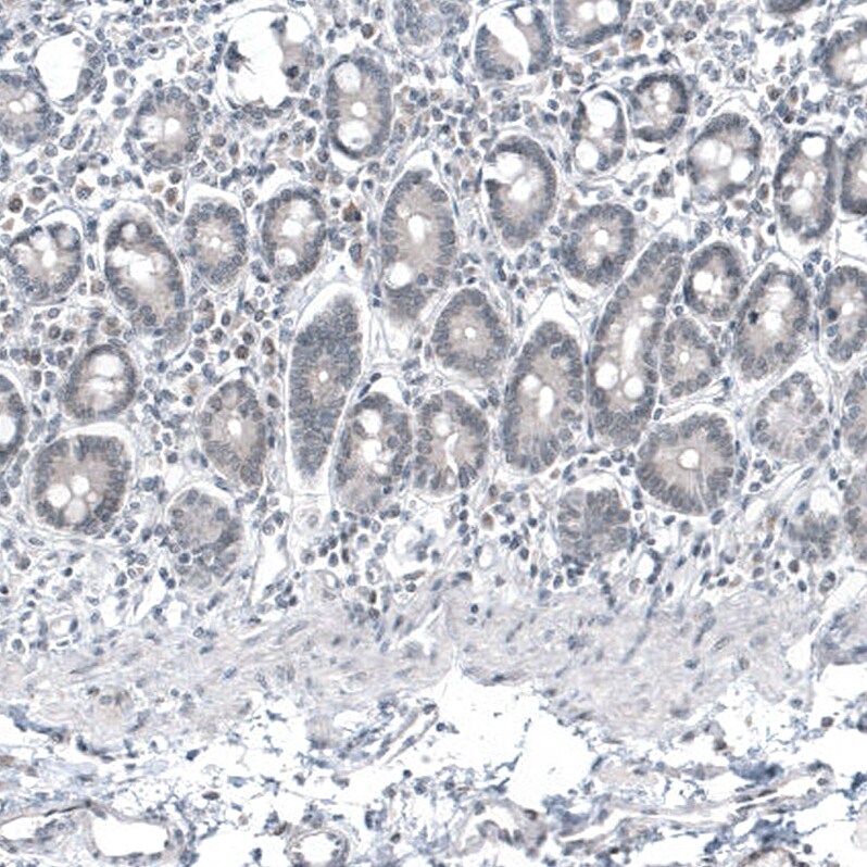 Mammaglobin A Antibody (CL8892) - Azide and BSA Free Immunohistochemistry-Paraffin: Mammaglobin A Antibody [NBP3-44237]