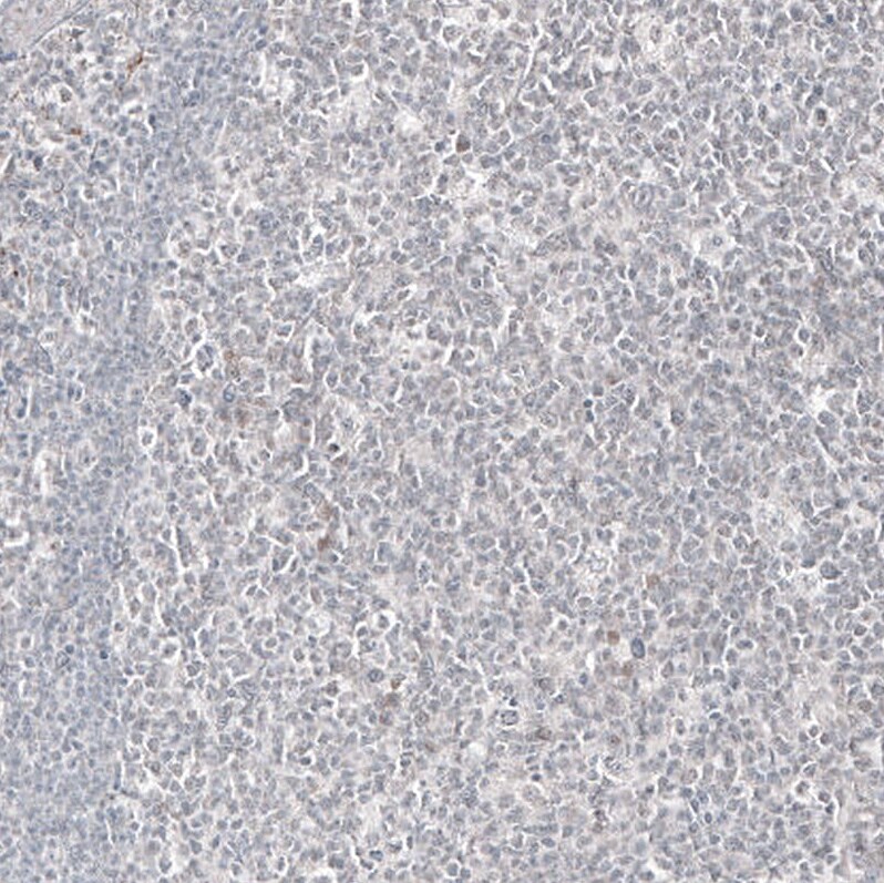 Mammaglobin A Antibody (CL8892) - Azide and BSA Free Immunohistochemistry-Paraffin: Mammaglobin A Antibody [NBP3-44237]