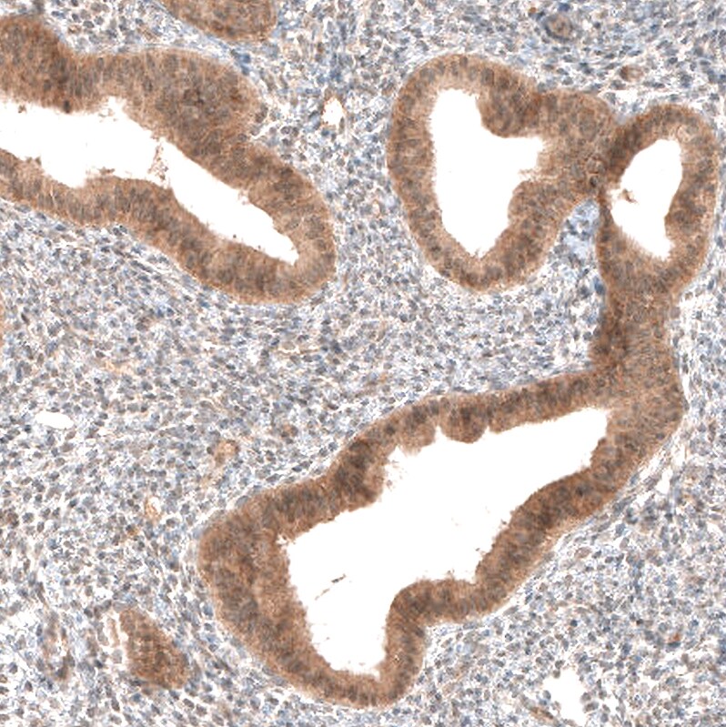PIK3CA Antibody (CL8347) - Azide and BSA Free Immunohistochemistry-Paraffin: PIK3CA Antibody [NBP3-44239]
