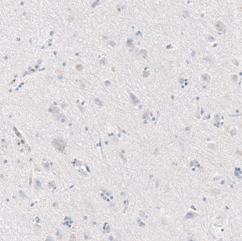 CXCL13/BLC/BCA-1 Antibody (CL10543) - Azide and BSA Free Immunohistochemistry-Paraffin: CXCL13/BLC/BCA-1 Antibody [NBP3-44241]