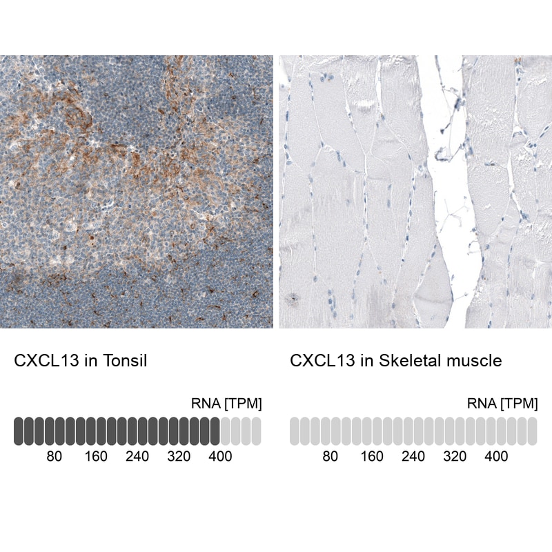 CXCL13/BLC/BCA-1 Antibody (CL10543) - Azide and BSA Free Immunohistochemistry-Paraffin: CXCL13/BLC/BCA-1 Antibody [NBP3-44241]