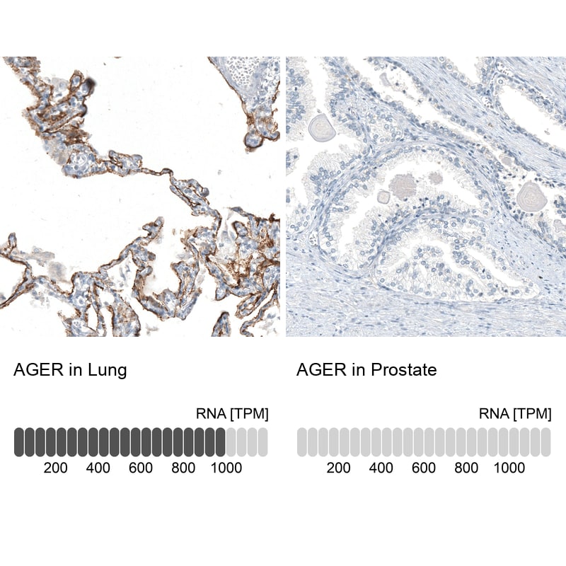 AGER Antibody (CL10587) - Azide and BSA Free Immunohistochemistry-Paraffin: AGER Antibody [NBP3-44242]