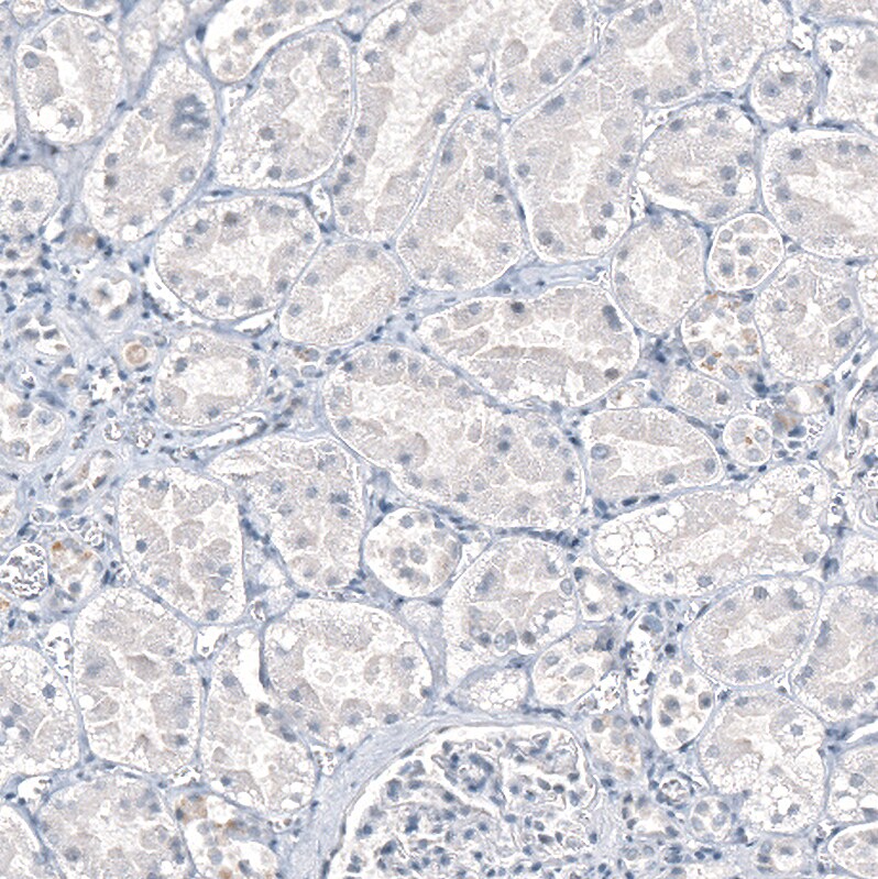 AGER Antibody (CL10587) - Azide and BSA Free Immunohistochemistry-Paraffin: AGER Antibody [NBP3-44242]