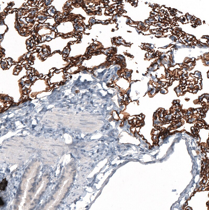 AGER Antibody (CL10587) - Azide and BSA Free Immunohistochemistry-Paraffin: AGER Antibody [NBP3-44242]