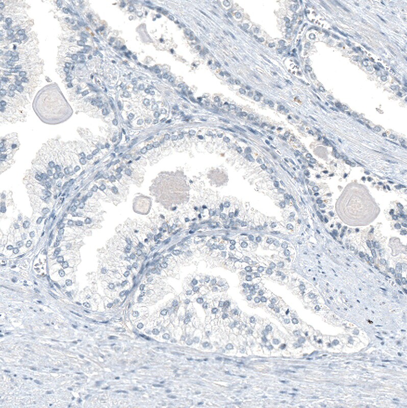 AGER Antibody (CL10587) - Azide and BSA Free Immunohistochemistry-Paraffin: AGER Antibody [NBP3-44242]
