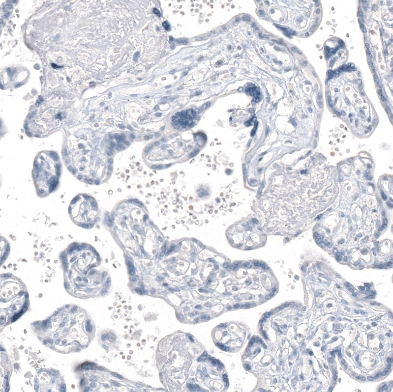 AGER Antibody (CL10587) - Azide and BSA Free Immunohistochemistry-Paraffin: AGER Antibody [NBP3-44242]