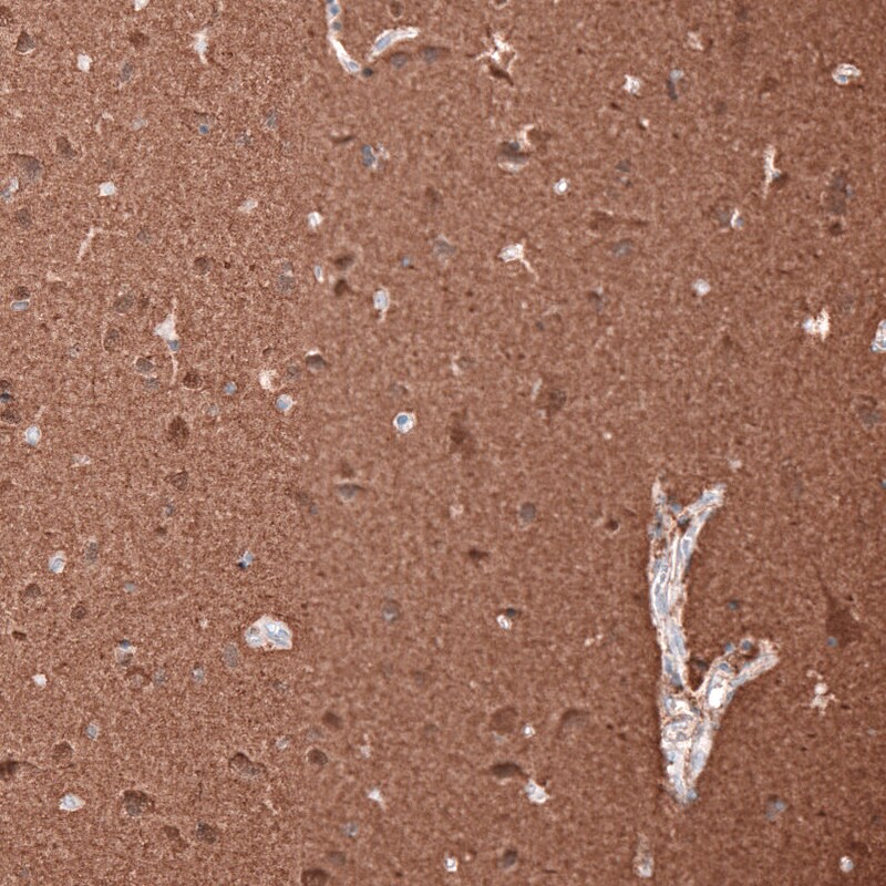 beta-III Tubulin Antibody (CL5813) - Azide and BSA Free Immunohistochemistry-Paraffin: beta-III Tubulin Antibody [NBP3-44243]