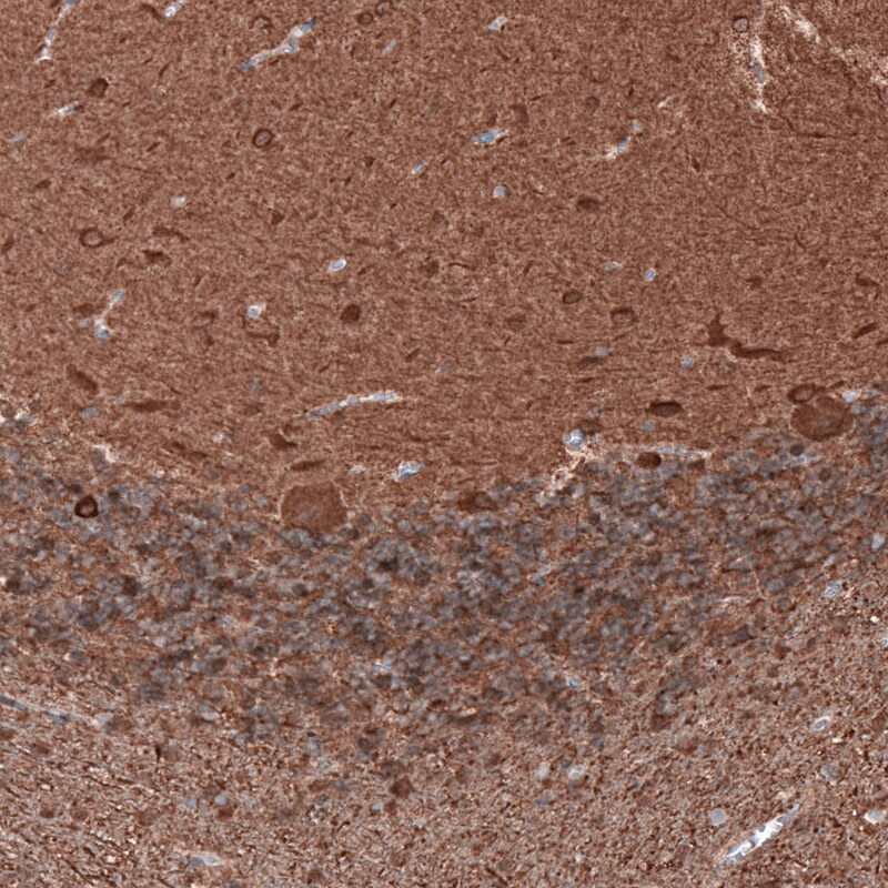 beta-III Tubulin Antibody (CL5813) - Azide and BSA Free Immunohistochemistry-Paraffin: beta-III Tubulin Antibody [NBP3-44243]