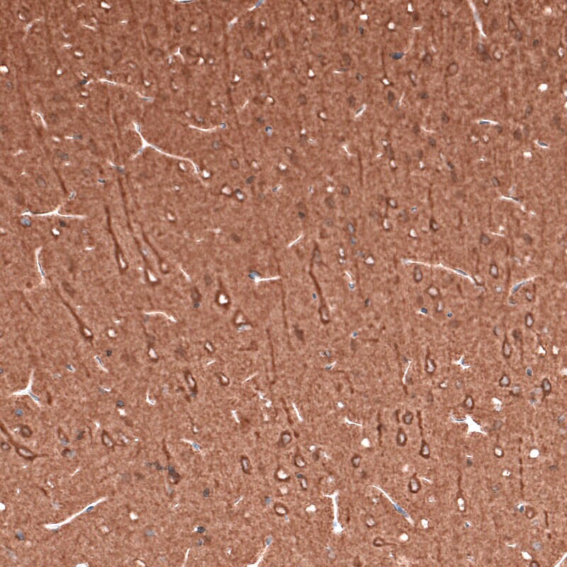 beta-III Tubulin Antibody (CL5813) - Azide and BSA Free Immunohistochemistry-Paraffin: beta-III Tubulin Antibody [NBP3-44243]