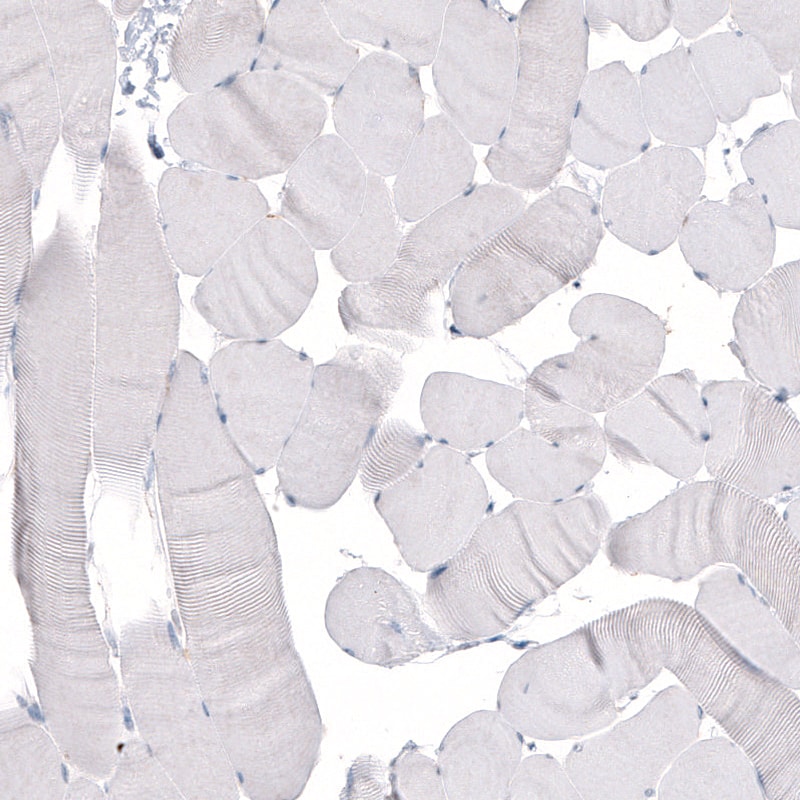 beta-III Tubulin Antibody (CL5813) - Azide and BSA Free Immunohistochemistry-Paraffin: beta-III Tubulin Antibody [NBP3-44243]