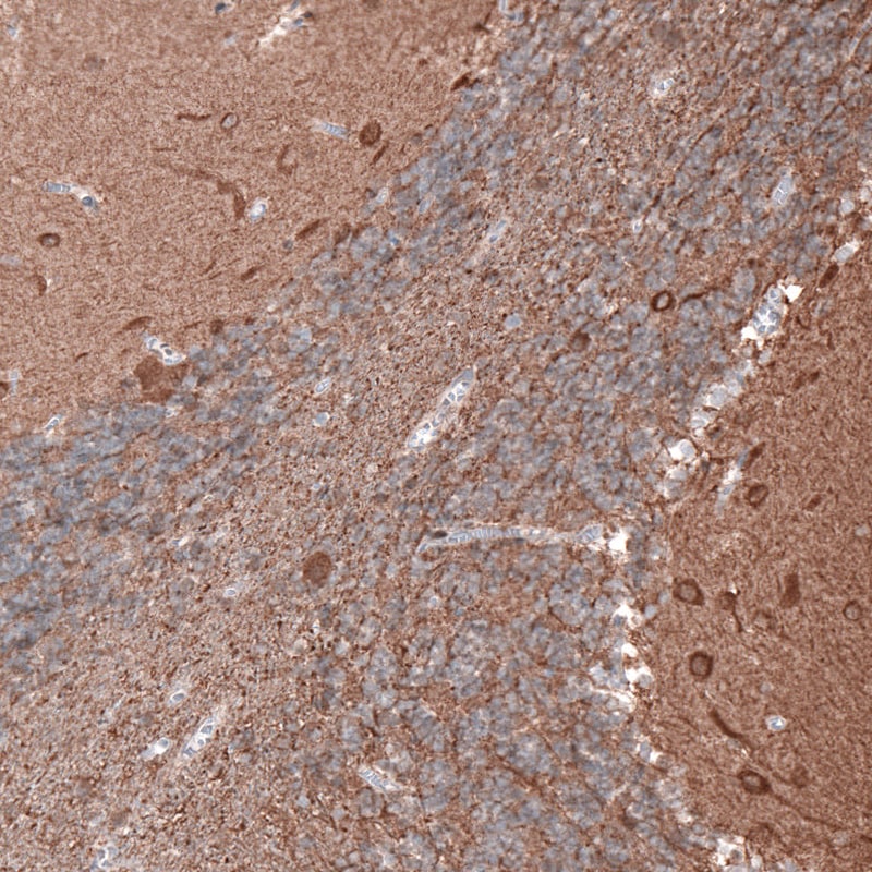 beta-III Tubulin Antibody (CL5814) - Azide and BSA Free Immunohistochemistry-Paraffin: beta-III Tubulin Antibody [NBP3-44244]
