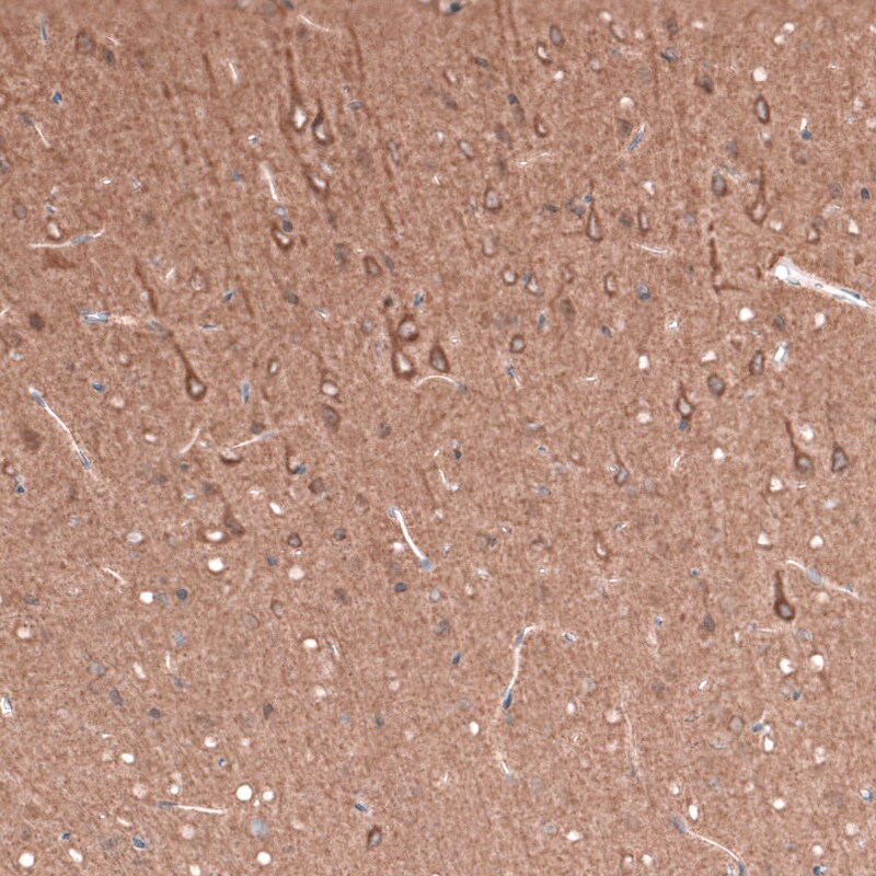 beta-III Tubulin Antibody (CL5814) - Azide and BSA Free Immunohistochemistry-Paraffin: beta-III Tubulin Antibody [NBP3-44244]