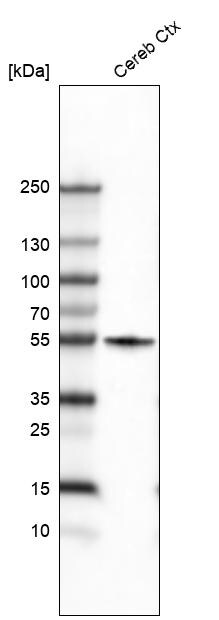 beta-III Tubulin Antibody (CL5814) - Azide and BSA Free Western Blot: beta-III Tubulin Antibody [NBP3-44244]