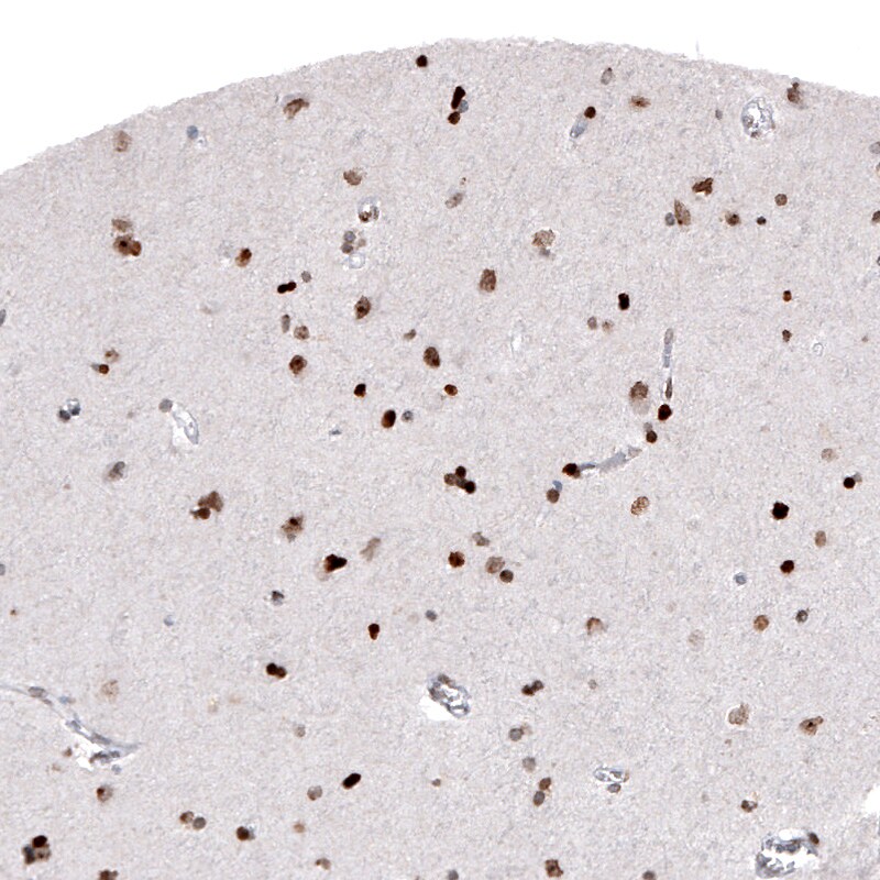 Macro H2A.2 Antibody (CL5263) - Azide and BSA Free Immunohistochemistry-Paraffin: Macro H2A.2 Antibody [NBP3-44246]
