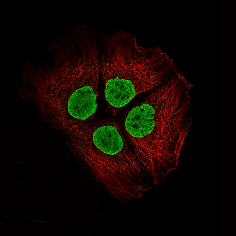 Histone H2AY/macroH2A.1 Antibody (CL5245) - Azide and BSA Free Immunocytochemistry/ Immunofluorescence: Histone H2AY/macroH2A.1 Antibody [NBP3-44248]